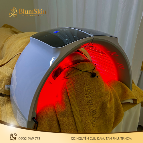 Phục hồi da cháy nắng