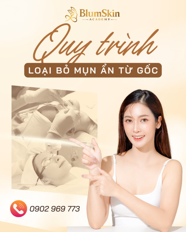 Tạm biệt mụn ẩn từ gốc