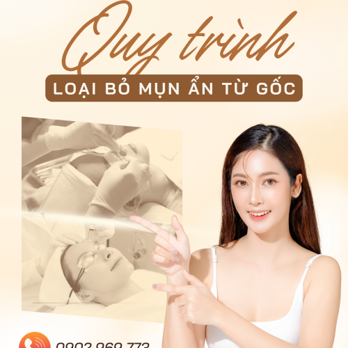 Tạm biệt mụn ẩn từ gốc