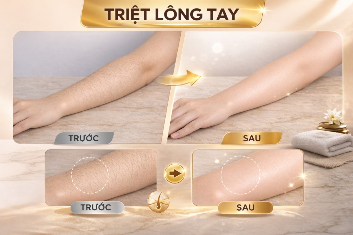 TẠM BIỆT "VI-Ô-LÔNG" – TỰ TIN DIỆN ĐỒ XINH RẠNG RỠ