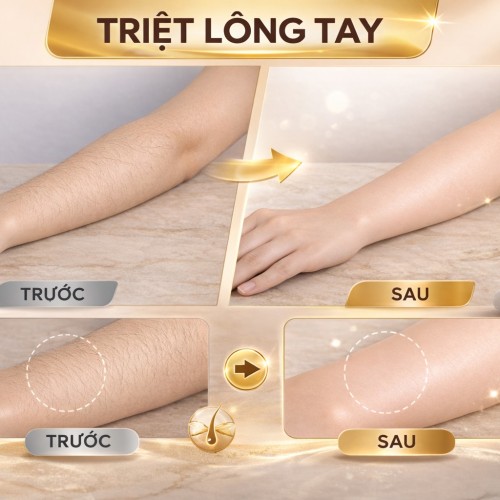 TẠM BIỆT "VI-Ô-LÔNG" – TỰ TIN DIỆN ĐỒ XINH RẠNG RỠ
